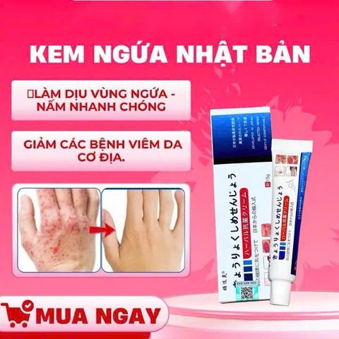 Kem Bôi Chăm Sóc Da Nhật Bản - Giảm Ngứa, Dưỡng Ẩm, Hỗ Trợ Cải Thiện Lác Đồng Tiền, Nấm Da Đầu, Á Sừng