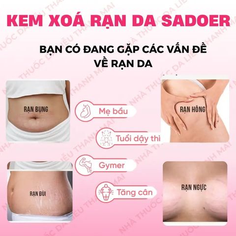 Kem Rạn Da 40g - Giúp Làm Mờ Vết Rạn Sau Sinh & Do Thay Đổi Cân Nặng, Cải Thiện Sẹo Lâu Năm, Dưỡng Ẩm Da Mềm Mại