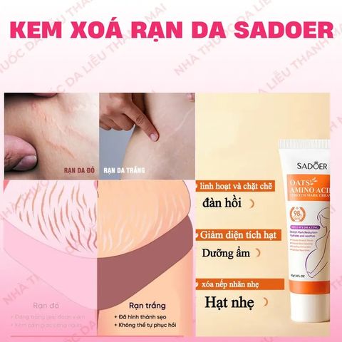 Kem Rạn Da 40g - Giúp Làm Mờ Vết Rạn Sau Sinh & Do Thay Đổi Cân Nặng, Cải Thiện Sẹo Lâu Năm, Dưỡng Ẩm Da Mềm Mại