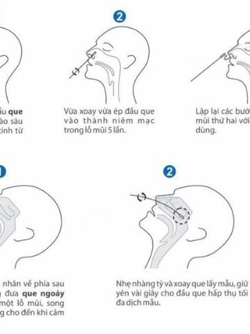 Bộ Test Nhanh COVID-19 OnSite CTK Biotech - Xét Nghiệm Kháng Nguyên SARS-CoV-2 FDA, CE, Kết Quả Trong 15 Phút