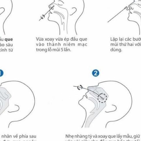 Que Test Nhanh Covid-19 Onsite Tại Nhà - Bộ Xét Nghiệm Kháng Nguyên SARS-CoV-2, 20 Test/Hộp, Kết Quả Trong 15 Phút
