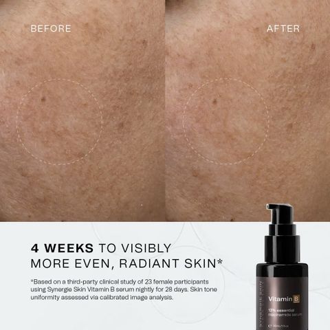Serum Vitamin B 13% Synergie Skin - serum Dưỡng ẩm,sáng da thu nhỏ Chân lông 30ml
