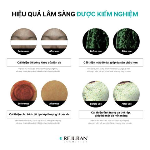 Serum Rejuran Ampoule c-PDRN - Tinh Chất Căng Bóng Da 30ml Giúp Cải Thiện Lão Hóa, Cung Cấp Độ Ẩm và Làm Sáng Da -nhập khẩu chính hãng
