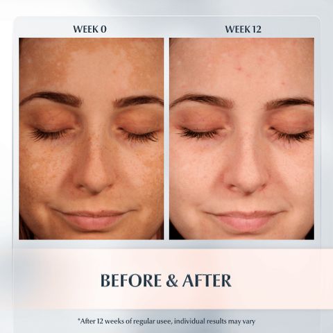 Serum Eucerin Anti-Pigment Dual 30ml - Tinh Chất Mờ Thâm Nám, Cấp Ẩm Rạng Rỡ, Dưỡng Sáng Da 2 Trong 1