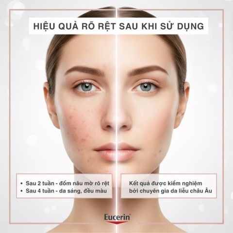 Tinh Chất Serum Eucerin Anti-Pigment 30ml - Hỗ Trợ Mờ Thâm, Sáng Da Cho Da Dầu - Dưỡng Ẩm, Kết Cấu Nhẹ Mịn