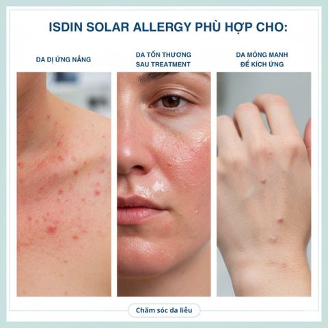 Kem Chống Nắng Isdin FotoUltra Solar Allergy Fusion Fluid SPF50+ - Bảo Vệ Da Nhạy Cảm, Dưỡng Ẩm và Làm Dịu Da 50ml