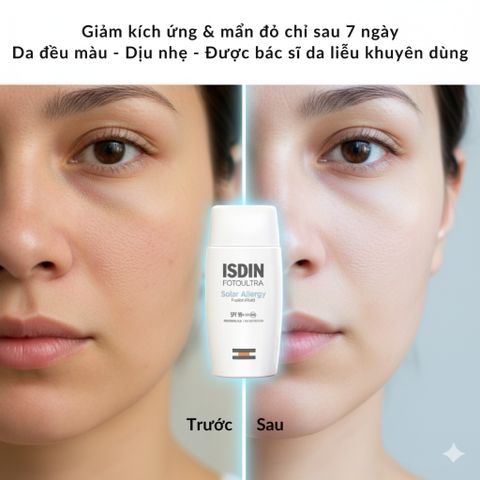 Kem Chống Nắng Isdin FotoUltra Solar Allergy Fusion Fluid SPF50+ - Bảo Vệ Da Nhạy Cảm, Dưỡng Ẩm và Làm Dịu Da 50ml