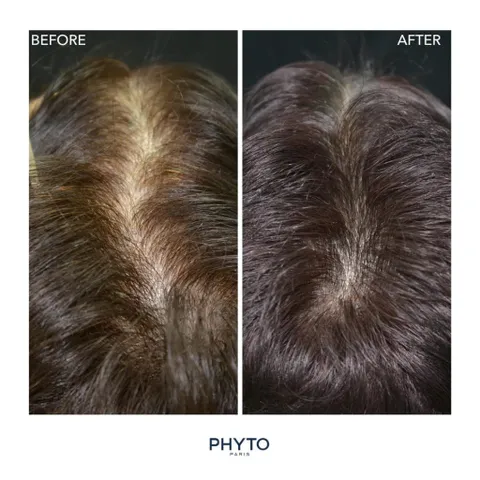 Tinh Chất Ngăn Rụng Tóc Nam Phyto Phytocyane Men Serum - Kích Thích Mọc Tóc & Tăng Mật Độ Tóc - 12 Ống Dưỡng Tóc Chất Lượng Cao