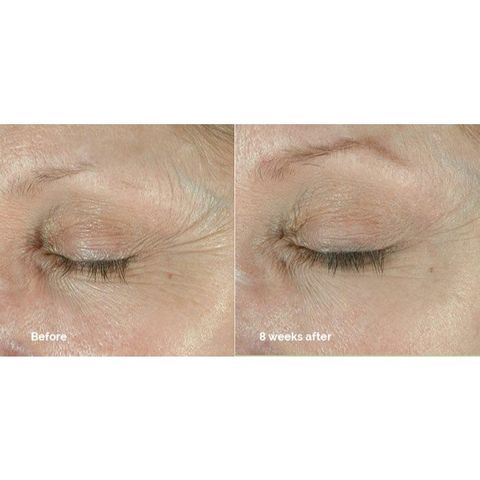 Kem Dưỡng Mắt Isdinceutics Hyaluronic Eyes 15g - Gel Cấp Ẩm Giảm Quầng Thâm, Làm Sáng Da Mắt, Hàng Chính Hãng Từ Tây Ban Nha