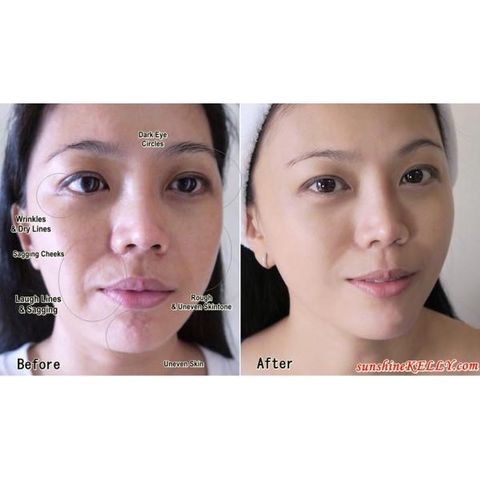 Tinh Chất Eucerin Hyaluron-Filler + Elasticity 3D Serum 30ml - Giảm Nếp Nhăn & Mờ Đốm Nâu cho Da Lão Hóa, Căng Mịn Rạng Rỡ