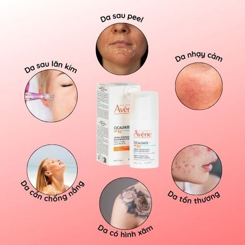Kem Bảo Vệ & Phục Hồi Da Avène Cicalfate+ SPF50+ - Chống Nắng, Dưỡng Ẩm, Làm Dịu Da Nhạy Cảm, Phục Hồi Tổn Thương Da