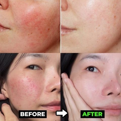 Kem Bảo Vệ & Phục Hồi Da Avène Cicalfate+ SPF50+ - Chống Nắng, Dưỡng Ẩm, Làm Dịu Da Nhạy Cảm, Phục Hồi Tổn Thương Da