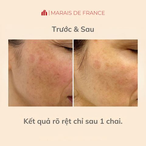 Tinh Chất Mờ Thâm Nám ISDIN Melaclear Advanced 30ml - Làm Sáng, Đều Màu Da, Ngừa Nám, Dưỡng Ẩm Da Mịn Màng