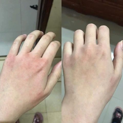 Kem Dưỡng Da Tay Eucerin Urea Repair Plus 75ml - Giảm Khô Nứt, Cấp Ẩm Sâu Cho Da Mềm Mịn, Phù Hợp Mọi Loại Da, Không Hương Liệu