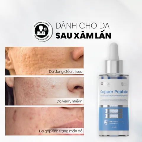 [Tặng Sữa rửa măt] Serum tăng sinh collagen, ngừa lão hóa làm đầy sẹo Md Care Copper Peptide 30ml
