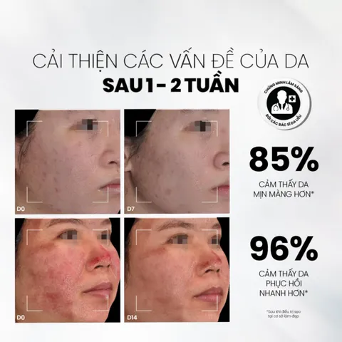 [Tặng Sữa rửa măt] Serum tăng sinh collagen, ngừa lão hóa làm đầy sẹo Md Care Copper Peptide 30ml