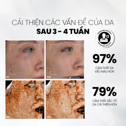 [Tặng SRM 30ML] Serum Trắng Sáng Da MD Care VitaC Arbutin 30ml - Dưỡng Ẩm, Làm Sáng Da nhanh+ 2 nạ NMF