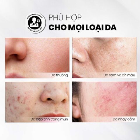 Tẩy Tế Bào Chết MD CARE Glow Exfo - Làm Sáng Da, Mờ Thâm, Cung Cấp Độ Ẩm Cho Làn Da Khỏe Mạnh