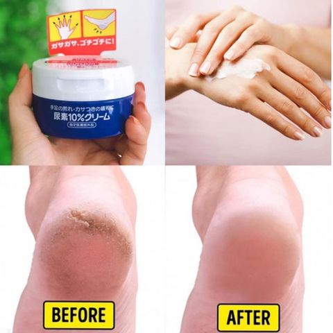 Kem Giảm Nứt Gót Chân Shiseido Urea Cream 10% - Dưỡng Ẩm Chuyên Sâu Cho Gót Chân Và Ngón Tay Nứt Nẻ, Hàng Nhập Khẩu Nhật Bản