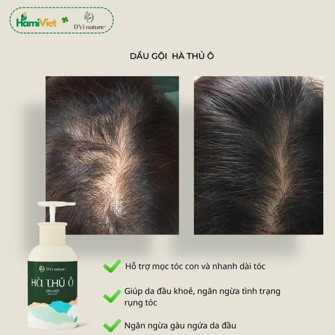Dầu Gội Hà Thủ Ô D'Vi Nature - Nuôi Dưỡng Tóc Bóng Mượt, Đàn Hồi, Giúp Làm Sạch Tóc và Loại Bỏ Gàu - 320ml