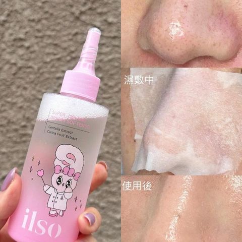 Dung Dịch Ủ Mụn ILSO Melting Sebum Softener 150g - Giải Pháp Làm Sạch Da, Loại Bỏ Mụn Đầu Đen và Sợi Bã Nhờn hiệu quả