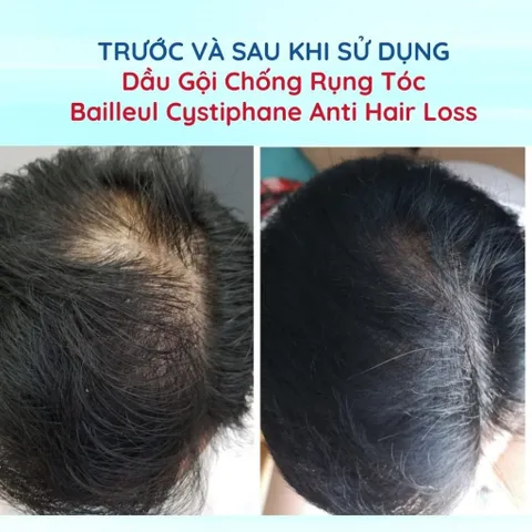 Dầu Gội Chống Rụng Tóc Bailleul Cystiphane 100ml - Giải Pháp Từ Pháp cho Tóc Khỏe Đẹp, Giảm Gãy Rụng, Phù Hợp Với Nam Nữ