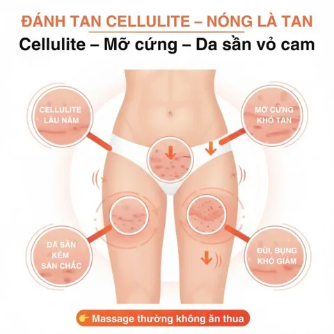 Kem Giảm Sần Vỏ Cam Somatoline - Kem Tan Mỡ Đùi và Mông Giúp Loại Bỏ Cellulite 250ml