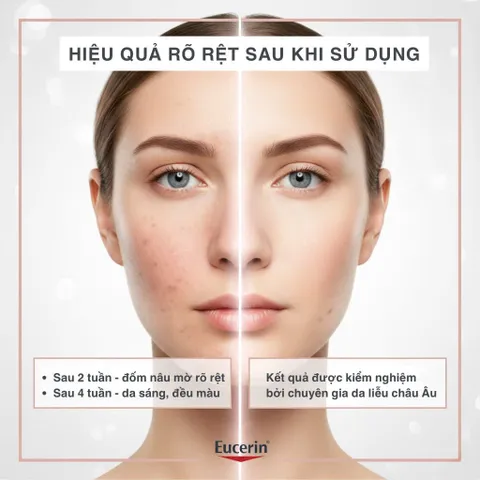 Serum Eucerin Anti-Pigment Eclat 30ml - Giảm Đốm Nâu, Thâm Nám, Làm Sáng Da Dầu và Hỗn Hợp