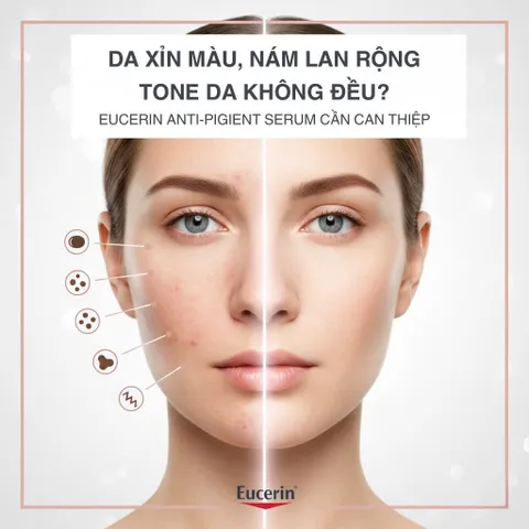 Serum Eucerin Anti-Pigment Eclat 30ml - Giảm Đốm Nâu, Thâm Nám, Làm Sáng Da Dầu và Hỗn Hợp
