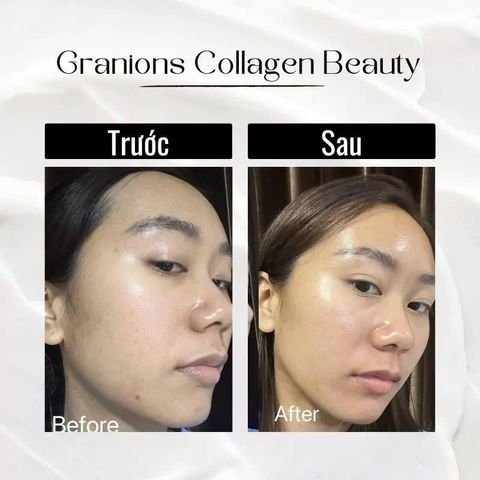 Viên Uống Granions Collagen 2500 mg - Thực Phẩm Bảo Vệ Sức Khỏe - 60 Viên - Tăng Cường Độ Đàn Hồi Cho Da, Xuất Xứ Pháp