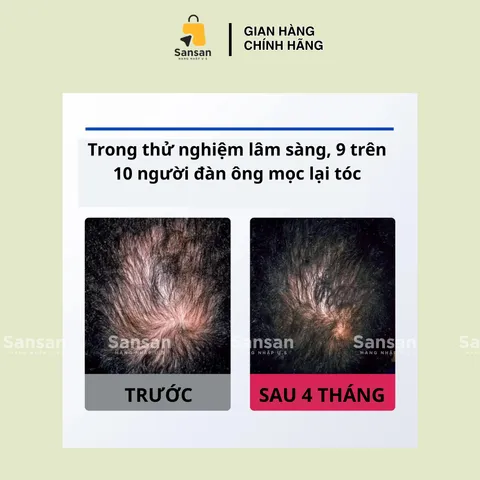 Rogaine 5% Minoxidil cho Nam giới - Hộp 3 Chai 60ml, Chống Rụng Tóc, Kích Thích Tóc Mọc, Sản Phẩm Bán Chạy Tại Mỹ