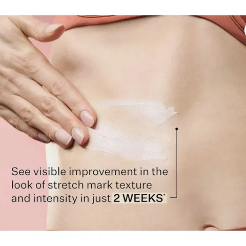 Set Kem Dưỡng Ẩm StriVectin SD Advanced Plus - Giảm Nếp Nhăn và Rạn Da (47ml x 2 tuýp) Mỹ - Làm Sáng Da, Duy Trì Collagen