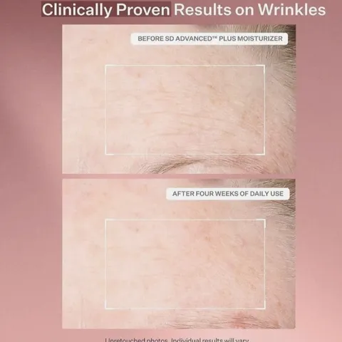 Set Kem Dưỡng Ẩm StriVectin SD Advanced Plus - Giảm Nếp Nhăn và Rạn Da (47ml x 2 tuýp) Mỹ - Làm Sáng Da, Duy Trì Collagen