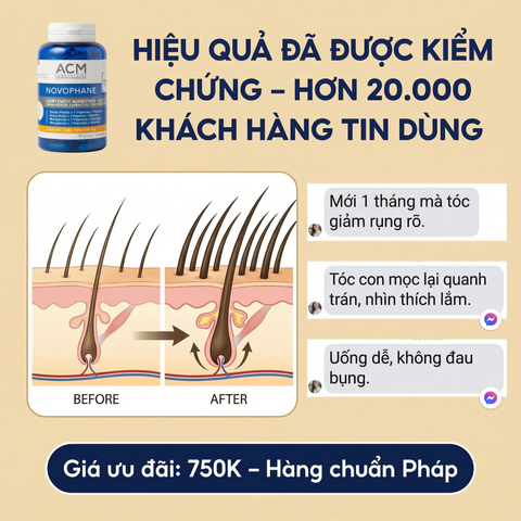 Viên Uống Giảm Rụng Tóc ACM Novophane 180 Viên - Giải Pháp Nuôi Dưỡng Tóc và Móng Khỏe Đẹp, Chứa Biotin và Vitamin C