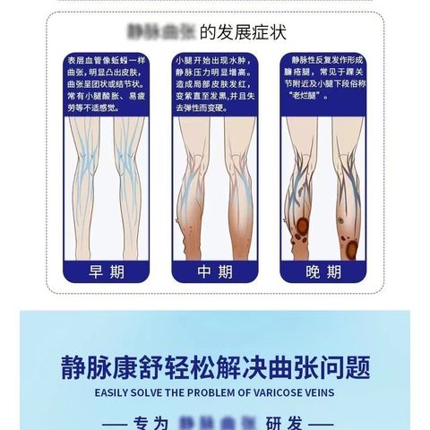 Cao Thoa Suy Giãn Tĩnh Mạch Kangshu 50g - Kem Hỗ Trợ Giảm Đau Nhức Chân, Phù Chân từ Nhật Bản - Sản Phẩm Chính Hãng Shimakyu