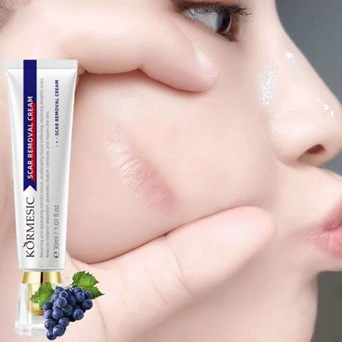 Kem Khử Thâm Mờ Sẹo Cũ - Scar Repair Cream, Giúp Làm Mờ Sẹo Lồi, Sẹo Bỏng, Sẹo Do Côn Trùng Cắn - Chăm Sóc Da Hiệu Quả
