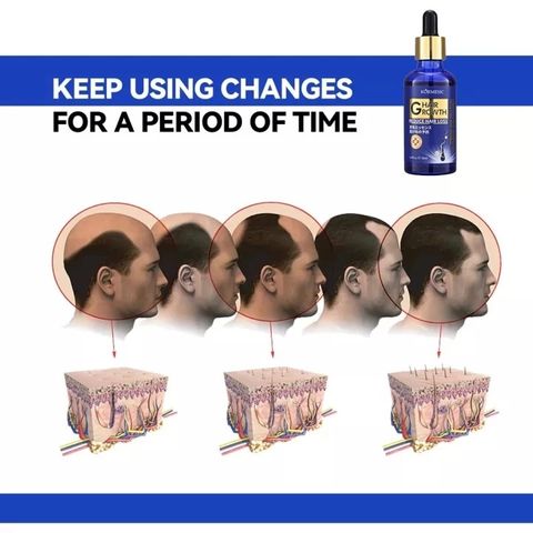 Tinh Chất Mọc Tóc Gừng Nhật Bản 50ml - Dầu Ủ Kích Thích Mọc Tóc Siêu Tốc, Phục Hồi Da Đầu, Trị Tóc Thưa Rụng