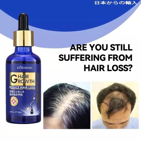 Tinh Chất Mọc Tóc Gừng Nhật Bản 50ml - Dầu Ủ Kích Thích Mọc Tóc Siêu Tốc, Phục Hồi Da Đầu, Trị Tóc Thưa Rụng