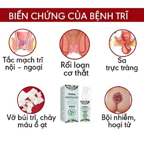 Xịt Bôi Giảm Đau Trĩ Nội Ngoại Tổng Hợp - Hỗ Trợ Chữa Ngứa, Đau Rát Hậu Môn, Cảm Giác Thoải Mái Hàng Ngày, Dung Tích 30ml