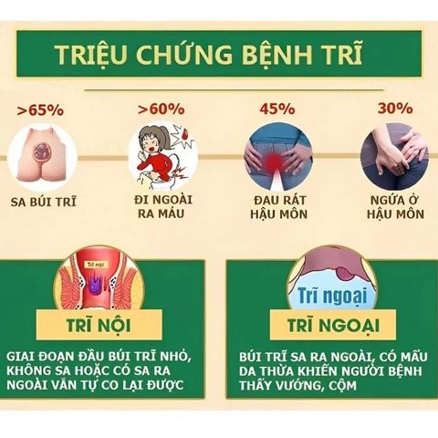 Xịt Bôi Giảm Đau Trĩ Nội Ngoại Tổng Hợp - Hỗ Trợ Chữa Ngứa, Đau Rát Hậu Môn, Cảm Giác Thoải Mái Hàng Ngày, Dung Tích 30ml