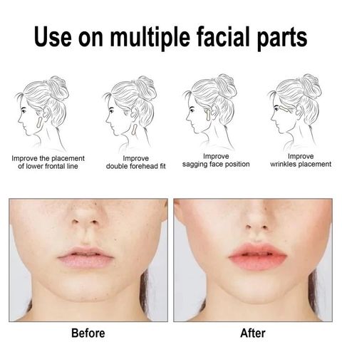 Hộp 60 Miếng Dán Nâng Cơ Mặt Trong Suốt Chống Nước - Sản Phẩm Làm Đẹp Tạo Khuôn Mặt Chữ V Thon Gọn Tự Nhiên