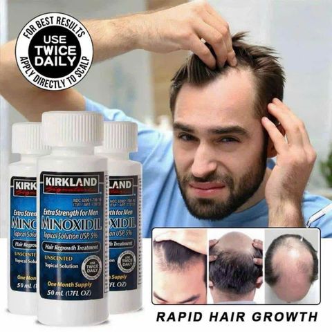 Tinh chất mọc tóc Minoxidil 5% Kirkland USA - Giải pháp trị hói đầu cho nam hiệu quả, tăng cường tự tin, FDA chứng nhận.