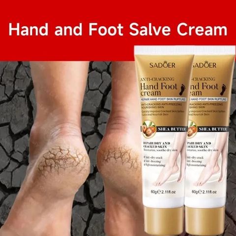 Kem Nứt Gót Chân Dưỡng Ẩm 60g - Chống Nứt Nẻ, Làm Mềm Da Gót Chân Khô Ráp, Phù Hợp Cho Người Đi Lại Nhiều
