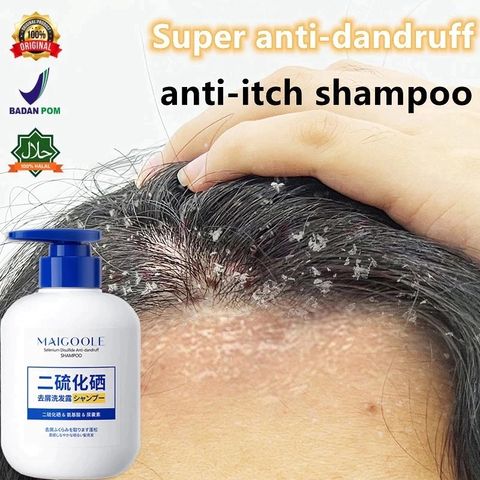 Dầu Gội Selenium Sulfide 300ml - Giải Pháp Chăm Sóc Tóc Gàu, Giảm Ngứa & Làm Sạch Da Đầu Hiệu Quả