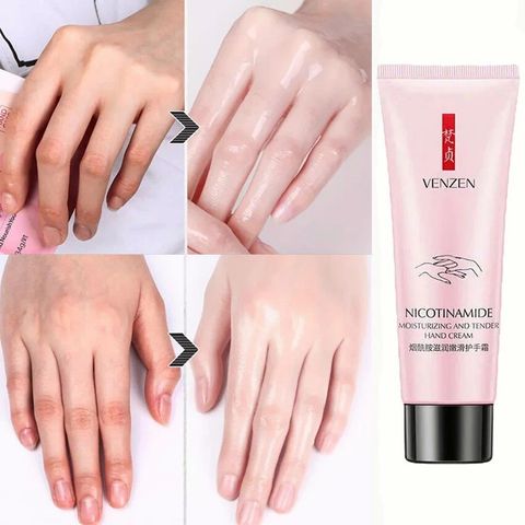 Kem Bôi Tay Dưỡng Da 80g - Dưỡng Ẩm, Làm Sáng Da, Chống Khô Nứt Nẻ Tay Chân - Sản Phẩm Chăm Sóc Da Tự Nhiên