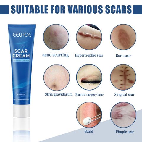 Kem Xóa Sẹo Hiệu Quả – Làm Mờ Sẹo Cũ, Sẹo Phẫu Thuật, Sẹo Mụn Trứng Cá & Vết Rạn Da, Dưỡng Da Mịn Màng, Mỹ Phẩm Hoa Kỳ