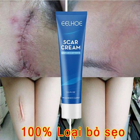 Kem Xóa Sẹo Hiệu Quả – Làm Mờ Sẹo Cũ, Sẹo Phẫu Thuật, Sẹo Mụn Trứng Cá & Vết Rạn Da, Dưỡng Da Mịn Màng, Mỹ Phẩm Hoa Kỳ