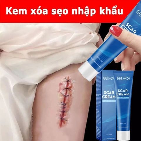 Kem Xóa Sẹo Hiệu Quả – Làm Mờ Sẹo Cũ, Sẹo Phẫu Thuật, Sẹo Mụn Trứng Cá & Vết Rạn Da, Dưỡng Da Mịn Màng, Mỹ Phẩm Hoa Kỳ