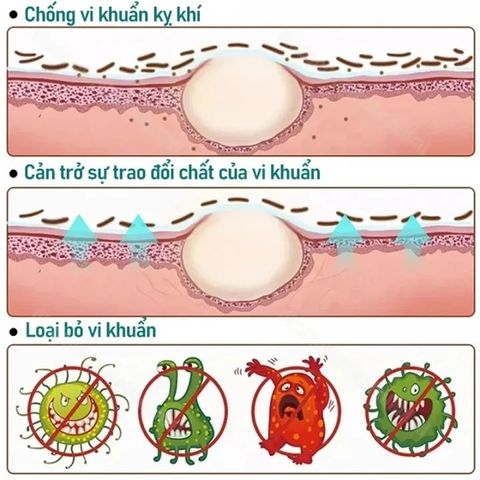 Kem Bôi Vảy Nến 20g - Hỗ Trợ Giảm Ngứa, Sản Phẩm Chăm Sóc Da Vảy Nến, Chàm, Tổ Đỉa, Ghẻ Nước, Hắc Lào, Lang Ben