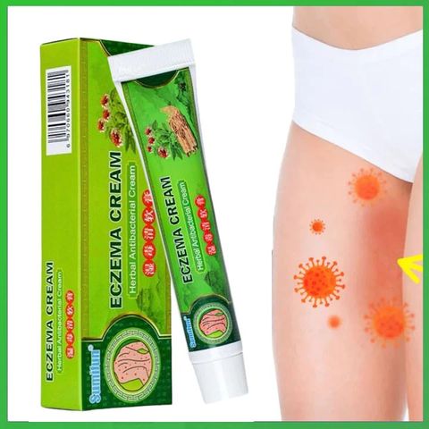 Kem Bôi Vảy Nến 20g - Hỗ Trợ Giảm Ngứa, Sản Phẩm Chăm Sóc Da Vảy Nến, Chàm, Tổ Đỉa, Ghẻ Nước, Hắc Lào, Lang Ben